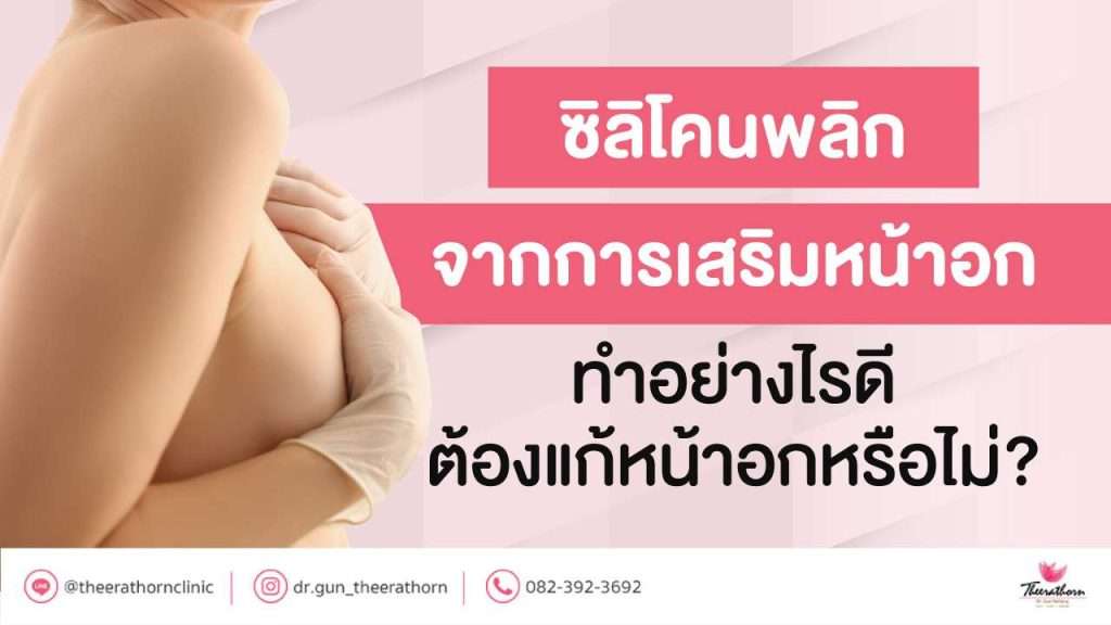 ซิลิโคนพลิก จากการเสริมหน้าอก ทำอย่างไรดี ต้องแก้หน้าอกหรือไม่?
