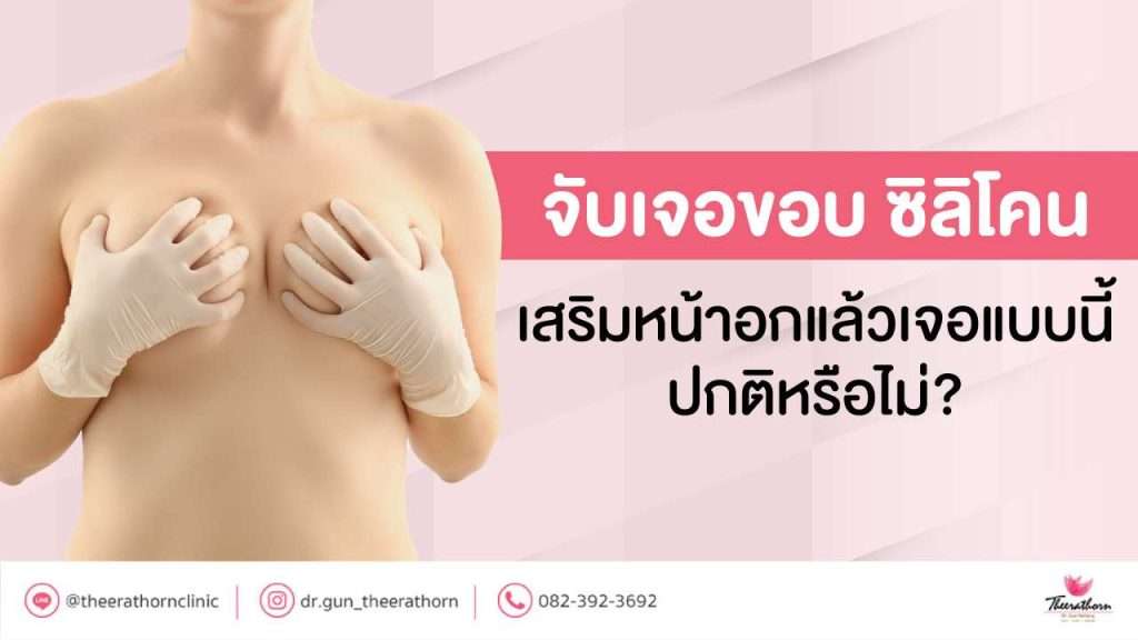 จับเจอขอบ ซิ ลิ โคน เสริมหน้าอกแล้วเจอแบบนี้ ปกติหรือไม่?
