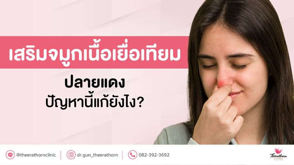 เสริมจมูกเนื้อเยื่อเทียม ปลายแดง ปัญหานี้แก้ยังไง?