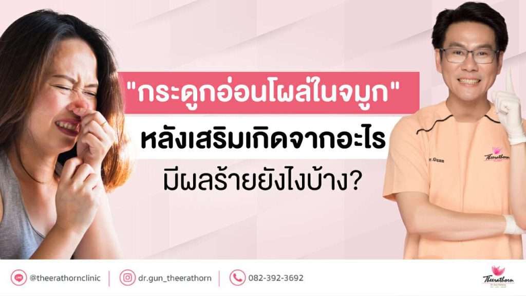 กระดูกอ่อน โผล่ ในจมูก หลังเสริมจมูก เกิดจากอะไร มีผลร้ายยังไงบ้าง?