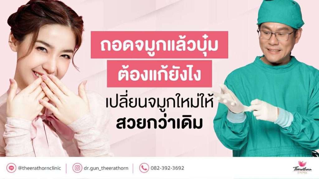 ถอดจมูกแล้วบุ๋ม ต้องแก้ยังไง เปลี่ยนจมูกใหม่ให้สวยกว่าเดิม
