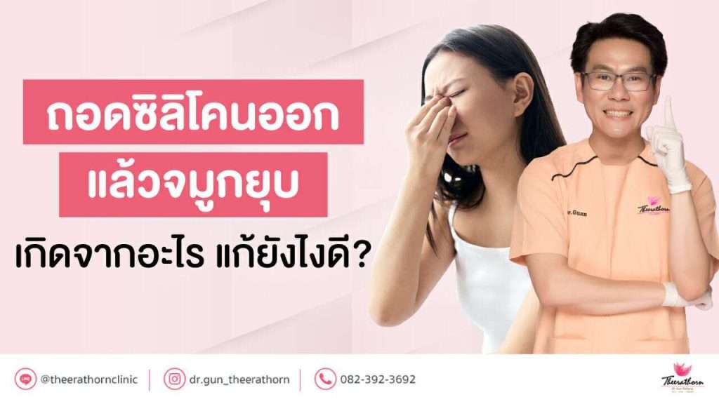 ถอดซิลิโคนออกแล้วจมูกยุบ เกิดจากอะไร แก้ยังไงดี?