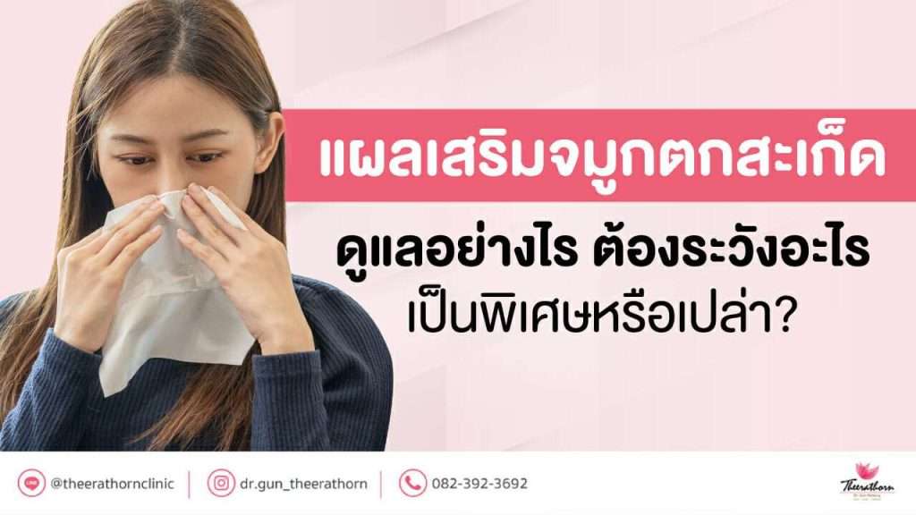 แผลเสริมจมูกตกสะเก็ด ดูแลอย่างไร ต้องระวังอะไรเป็นพิเศษหรือเปล่า?