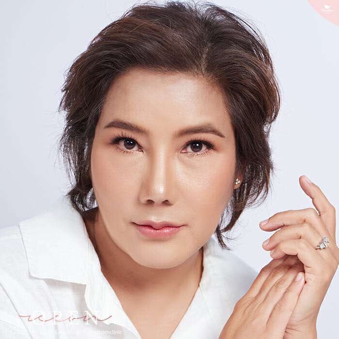 แก้จมูก, จมูกบุ๋ม, จมูกเกิดอุบัติเหตุ