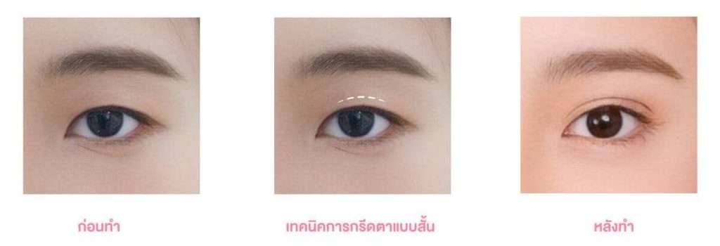 ตากรีดสั้น
