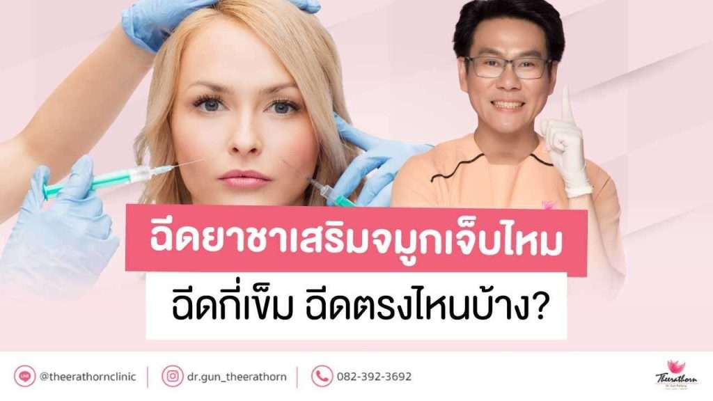 ฉีดยาชาเสริมจมูกเจ็บไหม ฉีดกี่เข็ม ฉีดตรงไหนบ้าง?
