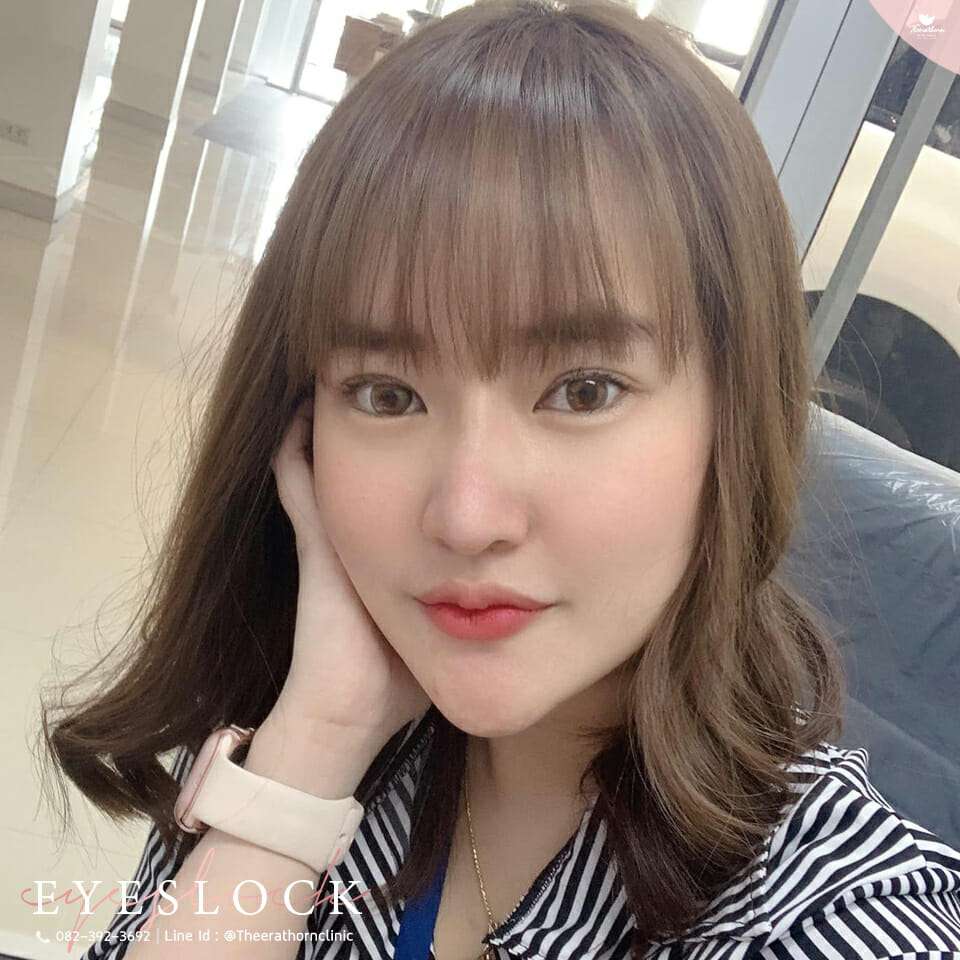 รีวิวตาสองชั้นกรีดยาว, ทำตา, แก้ตา