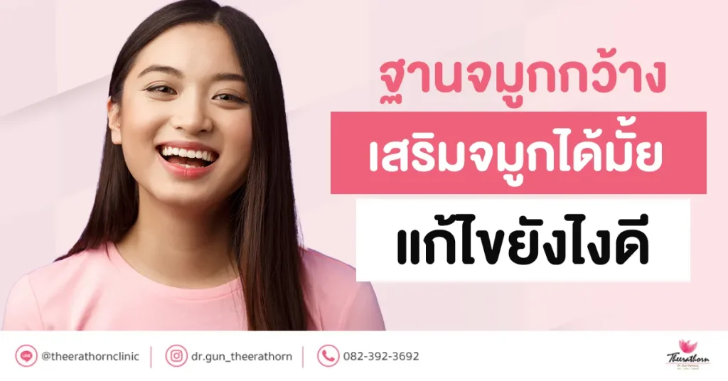 ฐานจมูกกว้าง