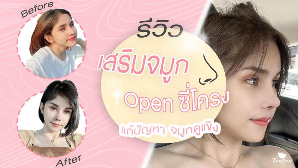 รีวิวแก้จมูก , ทรงแข็งทื่อ