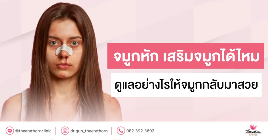 จมูกหัก