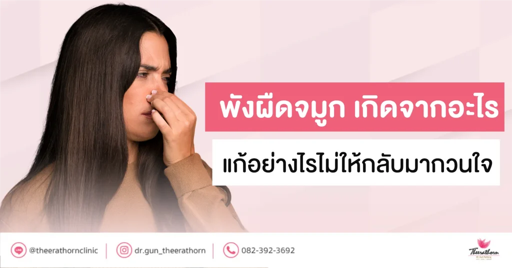 พังผืดจมูก