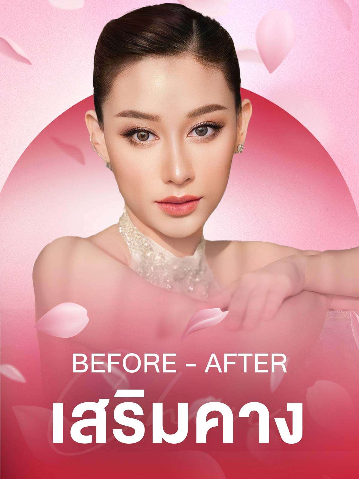ภาพก่อนหลังเสริมคาง