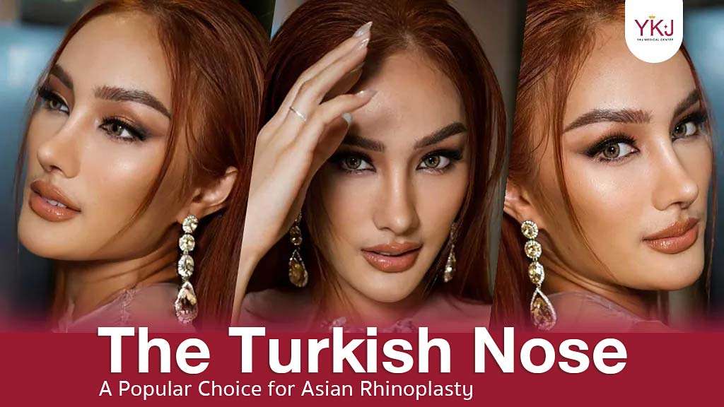 Turkish Nose , review
