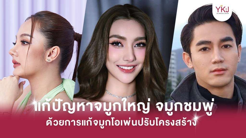 จมูกใหญ่ , จมูกหมู , จมูกชมพู่
