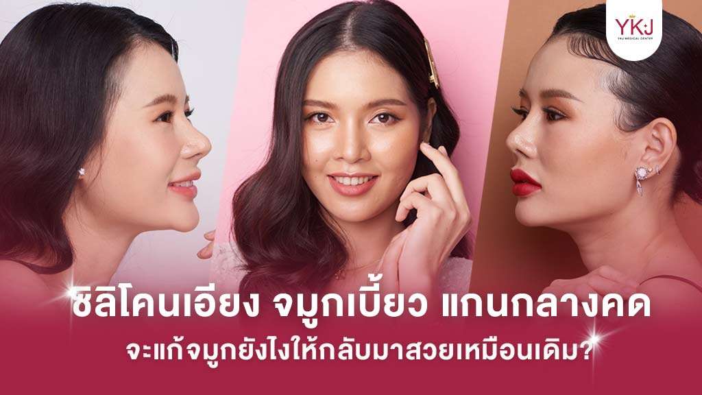ซิลิโคนเอียง , จมูกเบี้ยว