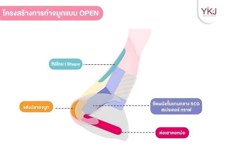 โครงสร้างจมูกโอเพ่น