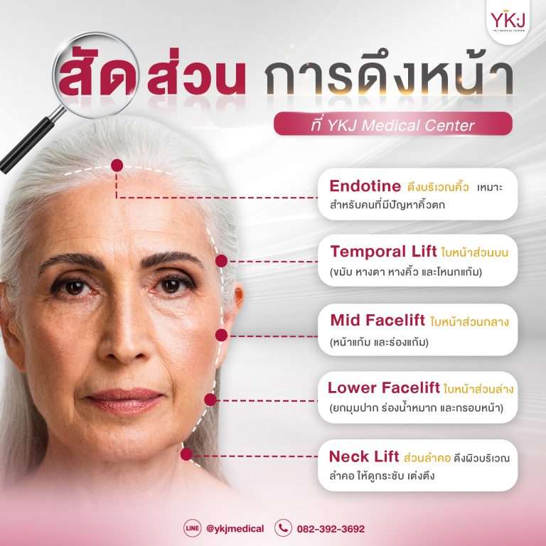 การดึงหน้า-ดึงหน้า-facelift