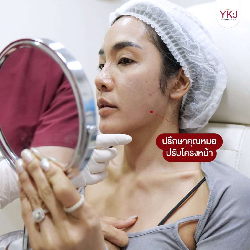 ฟิลเลอร์-filler