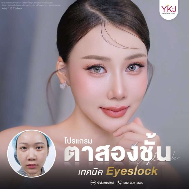 รีวิวตาสองชั้น , รีวิวแก้ตาสองชั้น, ทำตาสองชั้น