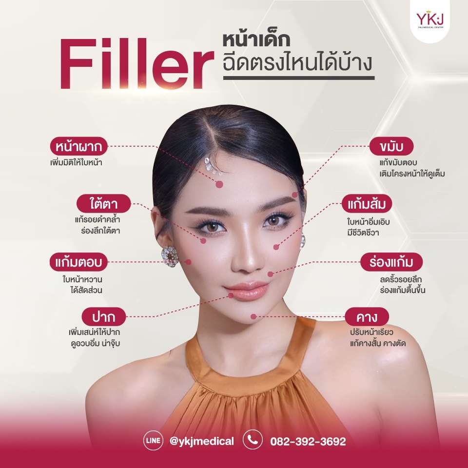 YvoireและRestylane-Yvoire and Restylane