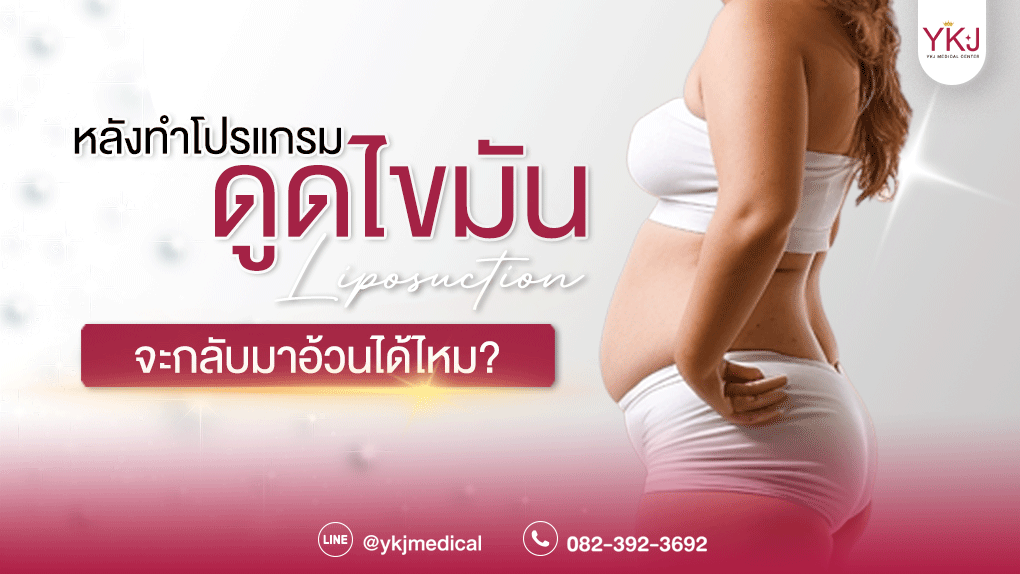 ดูดไขมัน-Liposuction