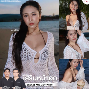 ซิลิโคนหน้าอก-หน้าอก-Breast Implant