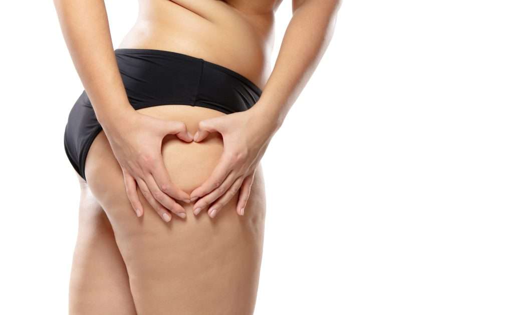 เซลลูไลท์-Cellulite