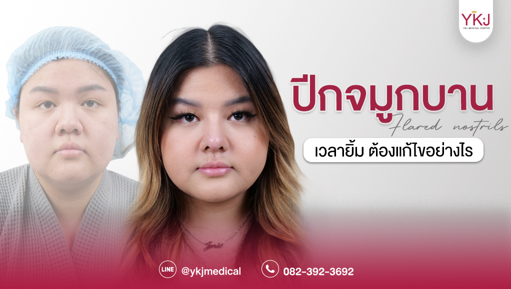 ปีกจมูกบาน-Flared nostrils