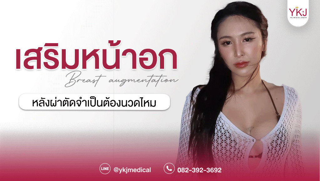 เสริมหน้าอก-Breast augmentation