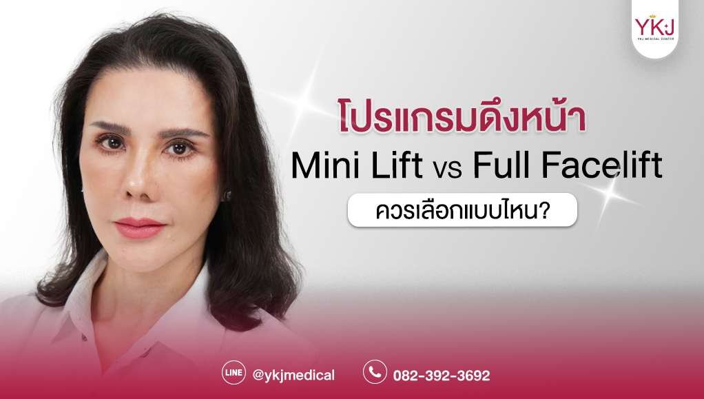 ดึงหน้า-Mini Lift-Full Facelift