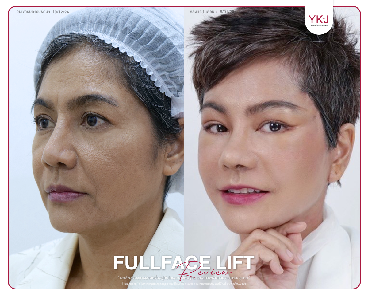 B-A ดึงหน้าพี่ปอนด์3 B-A ดึงหน้าพี่ปอนด์3